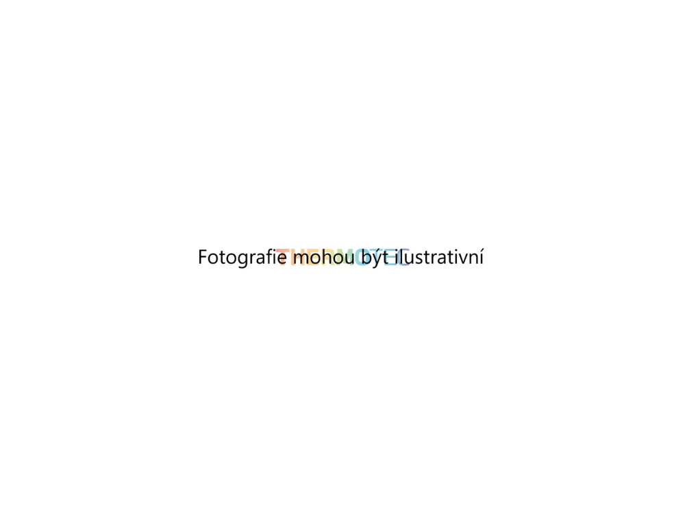 Chladič, chlazení motoru (THERMOTEC D78001TT) 5735896 Chladič, chlazení motoru (THERMOTEC D78001TT) 5735896